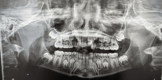 orthodontics x-ray